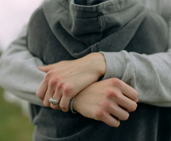 Doe v. Essentia Health: Protecting Trans Young People’s Right to Access Gender-Affirming Care